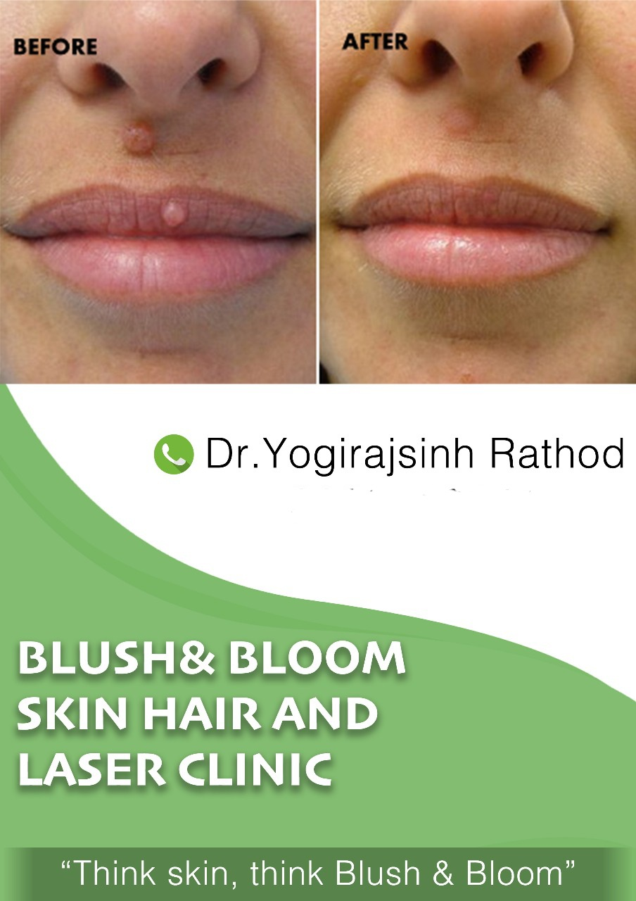 Think_Skin_Think_Blush_& _Bloom skin_specialist... main image