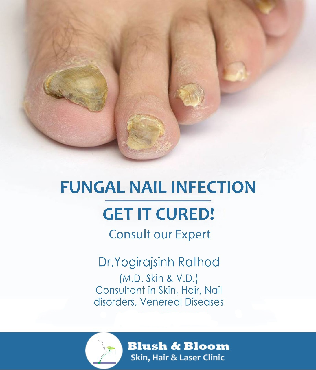 tired of nail problems?
get the best treatment ... main image