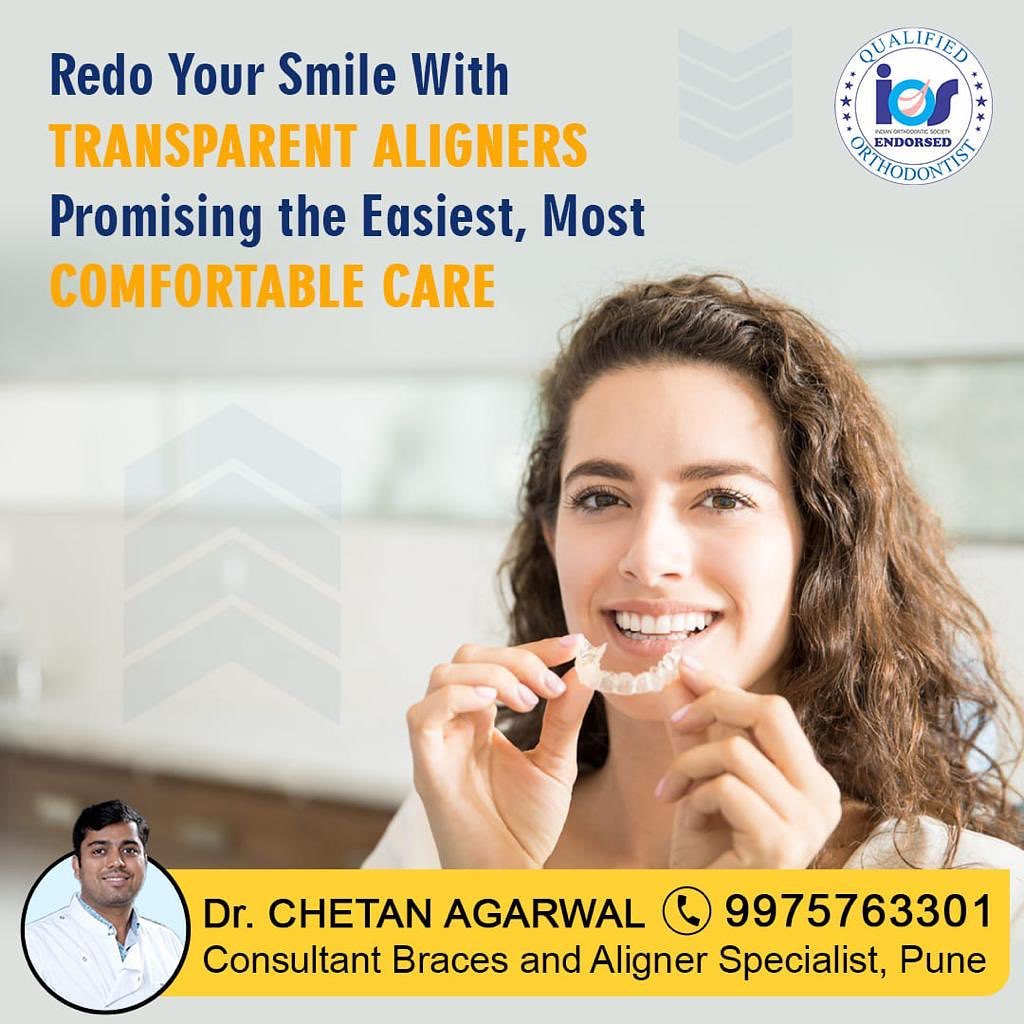 #Aligners are great to straighten teeth, but re... main image