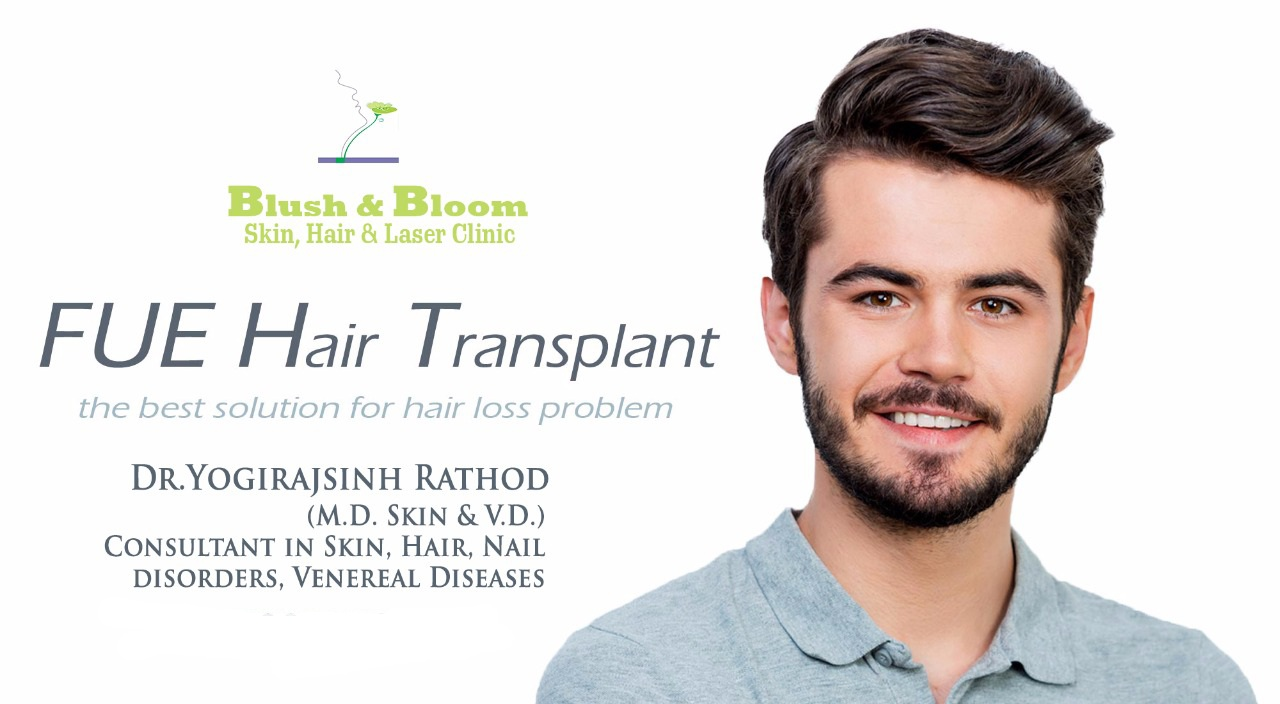 Hair transplant is a medical procedure that inv... main image