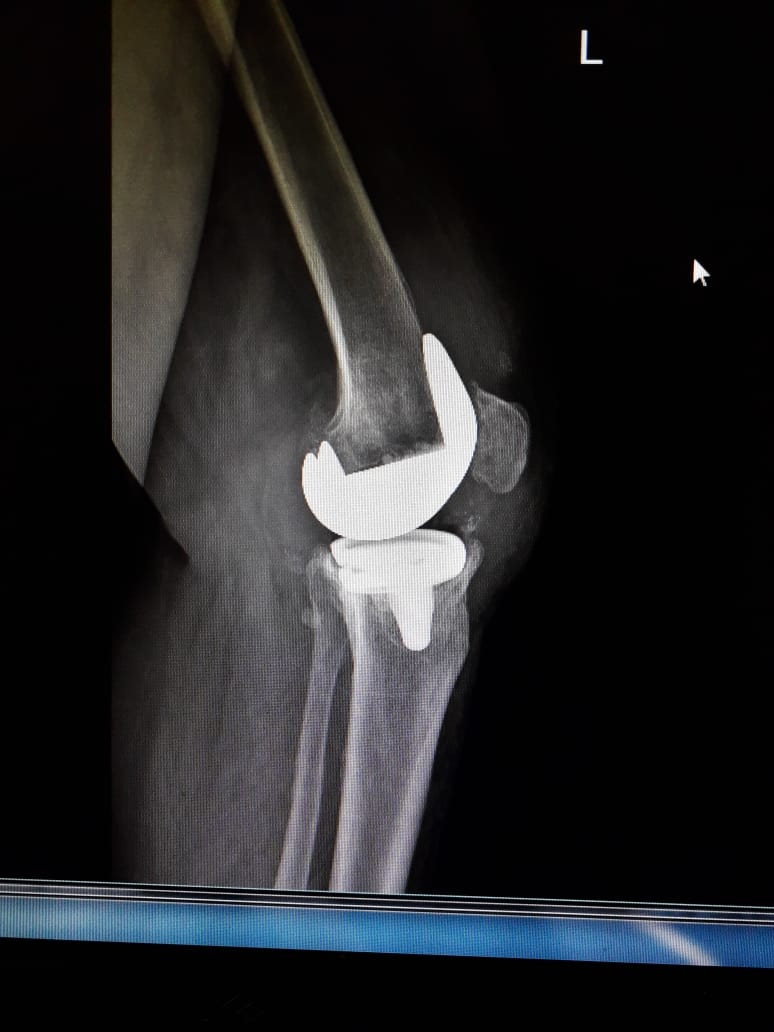 Are you suffering from knee pain?
Knee pain can... main image
