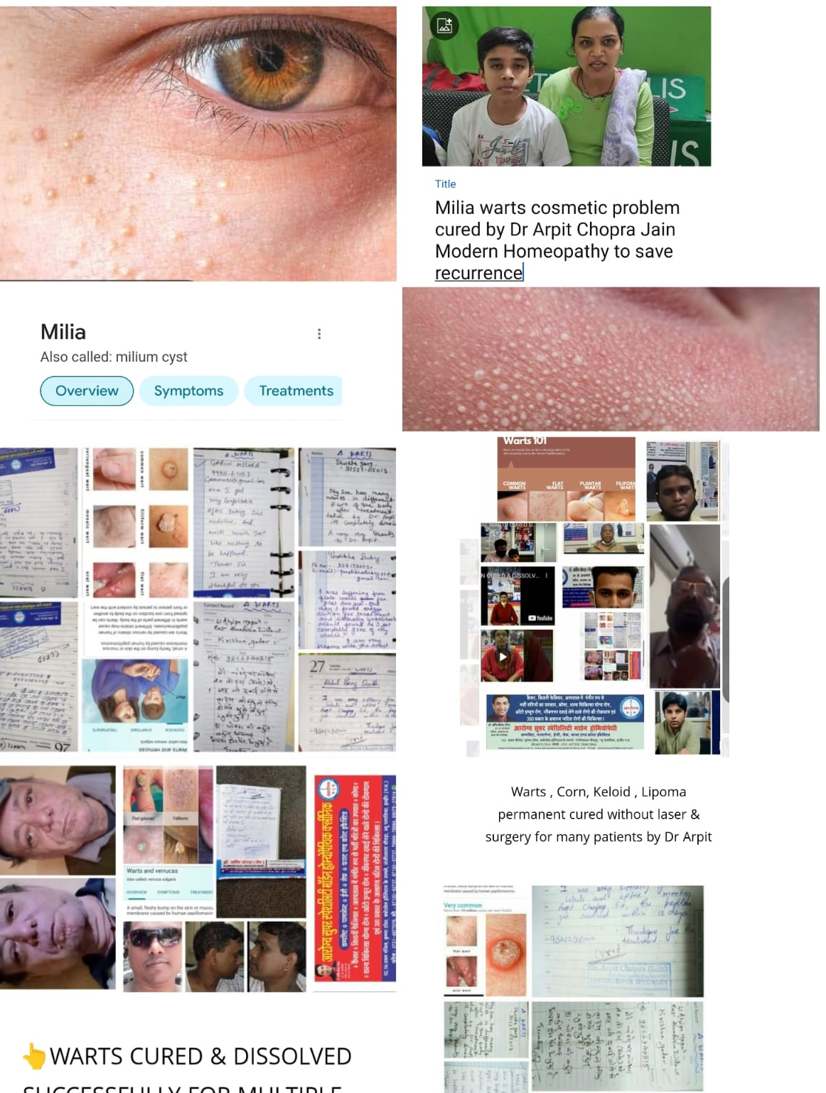 update image