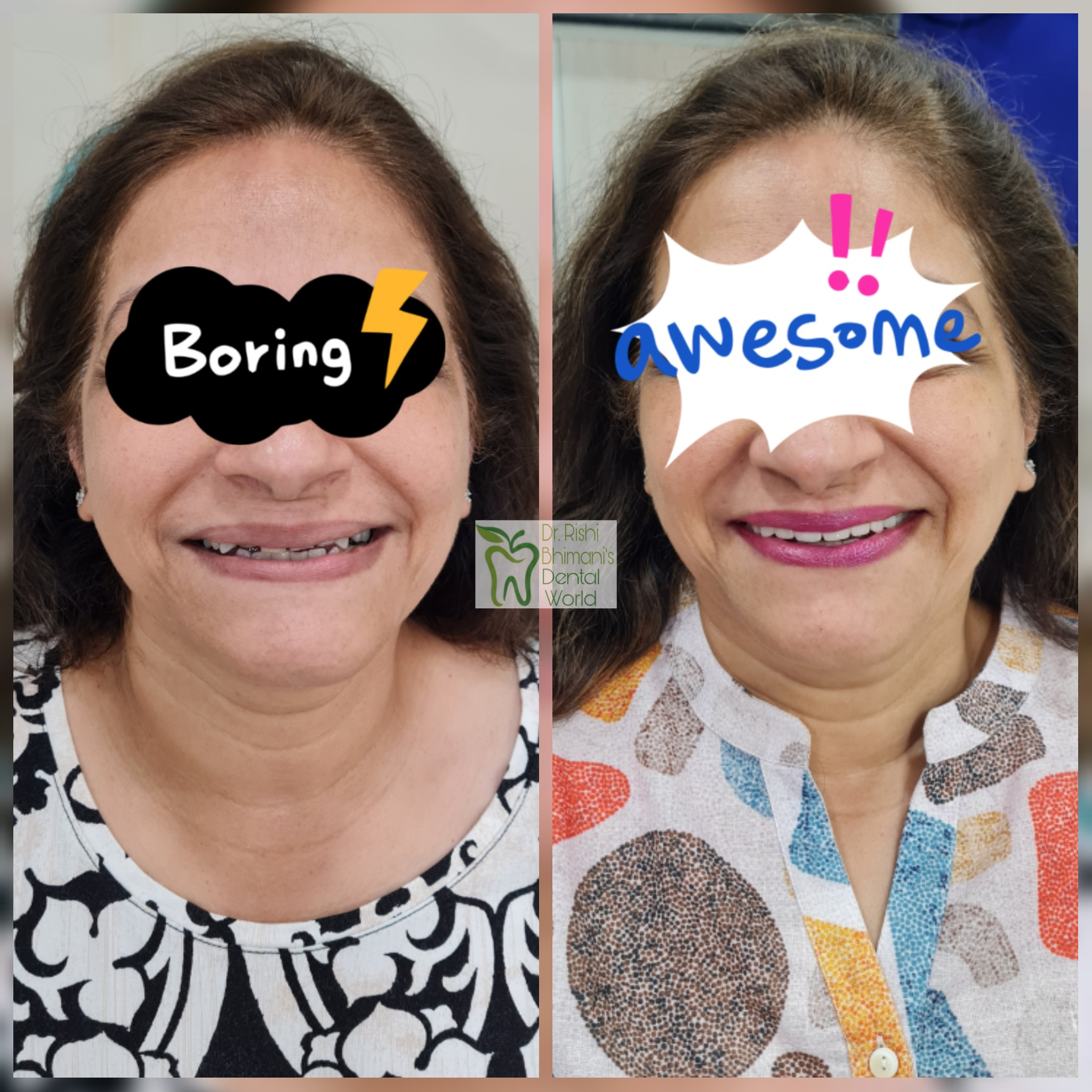 Smile Designing is a treatment option in which ... main image