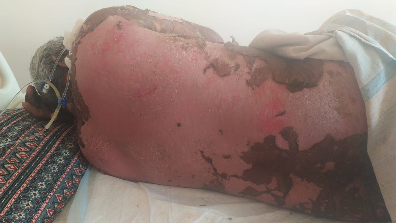 PT RESPONDED VERY WELL TO MEDICINES , RECOVERED FU... main image