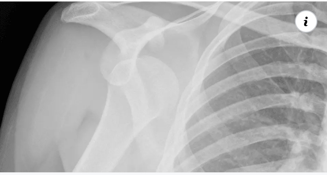 SUNSHINE Ⓡ
SUPER SPECIALITY PHYSIOTHERAPY CLINIC ... main image