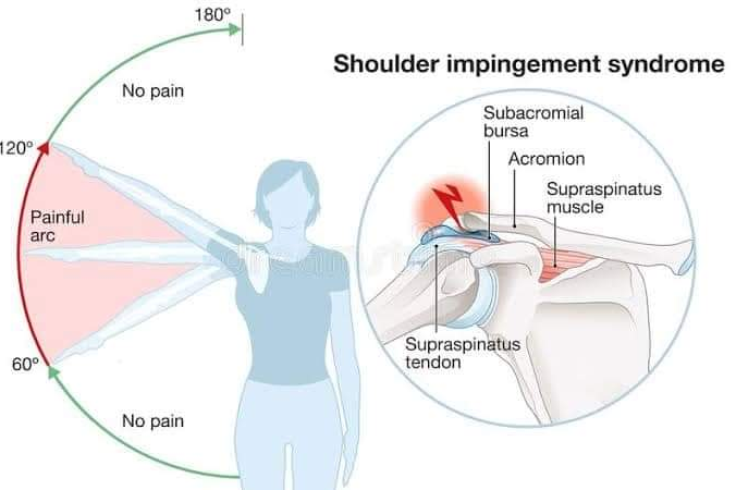 Physiotherapy clinic in Tambaram
Are you Looking f... main image