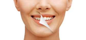 SMILE MAKEOVER Kanod