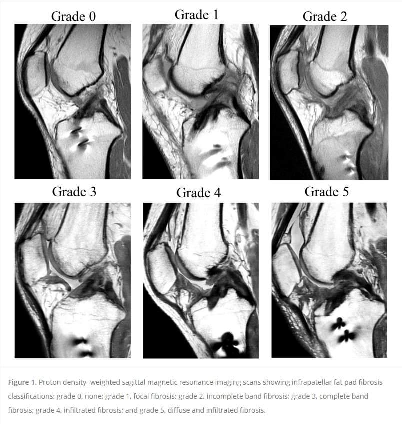 Physiotherapy clinic in Tambaram
Are you Looking f... main image