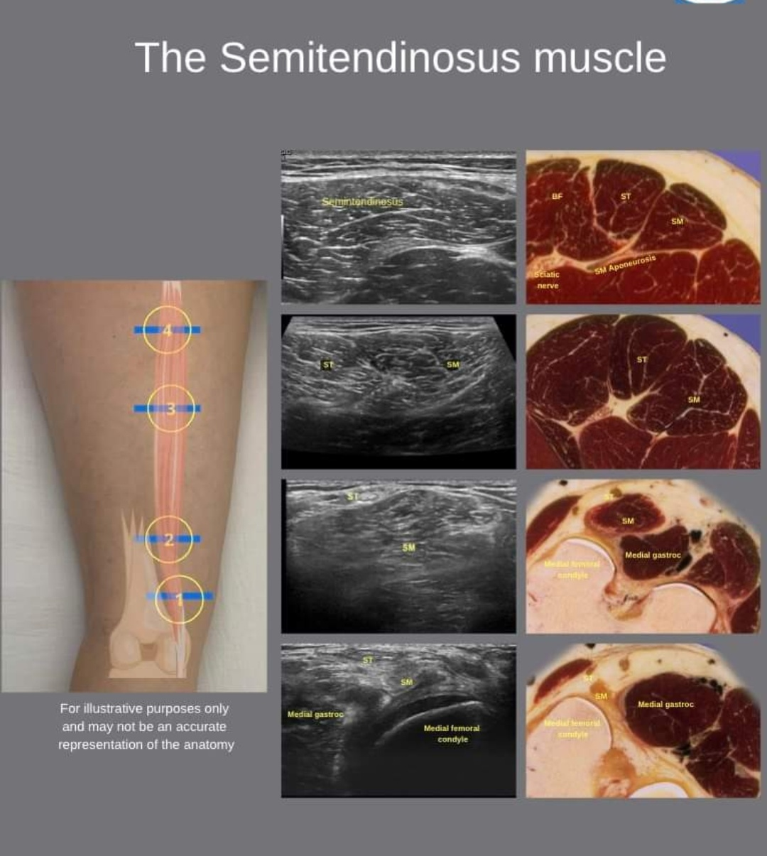 Physiotherapy clinic in Tambaram
Are you Looking f... main image