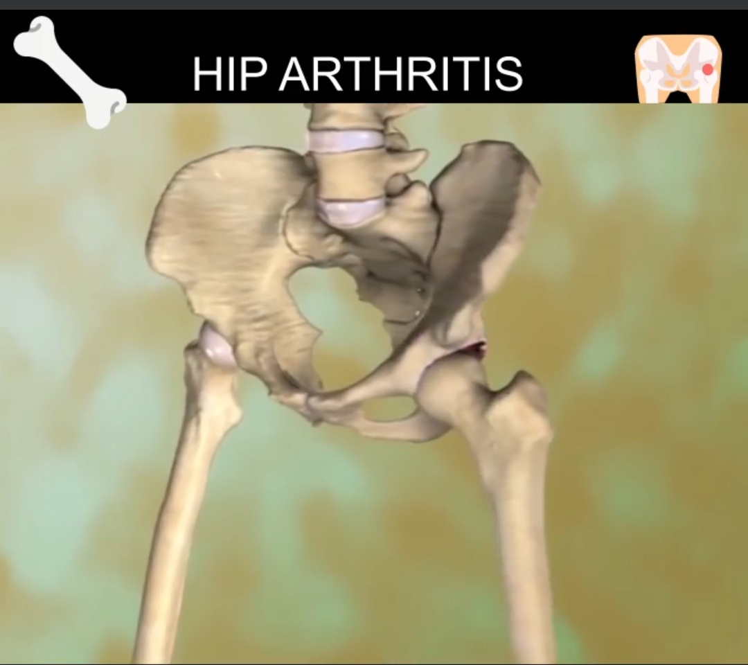 Physiotherapy clinic in Tambaram
Are you Looking f... main image