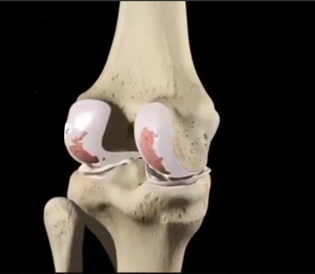 Physiotherapy clinic in Tambaram
Are you Looking f... main image