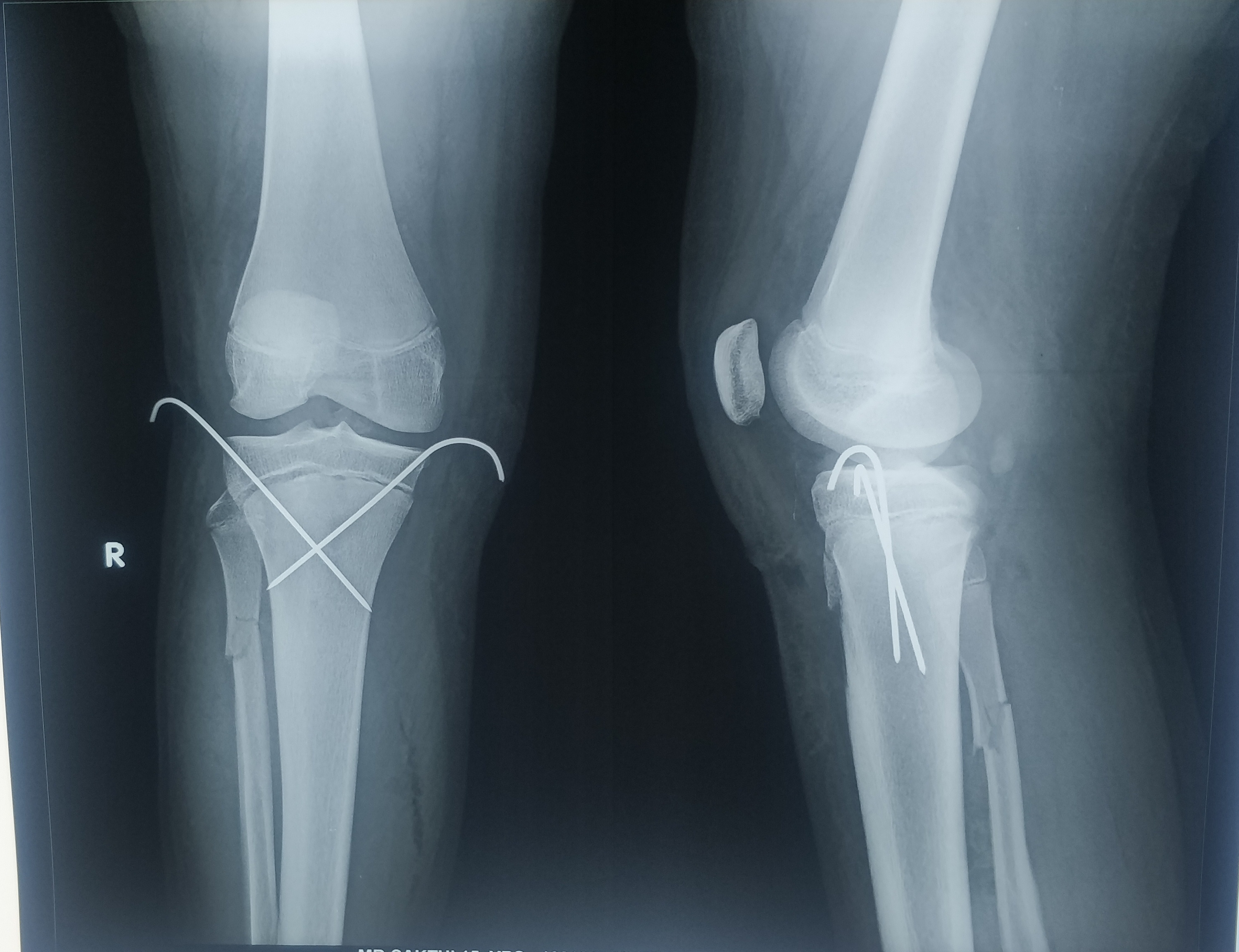 Physiotherapy clinic in Tambaram
Are you Looking f... main image