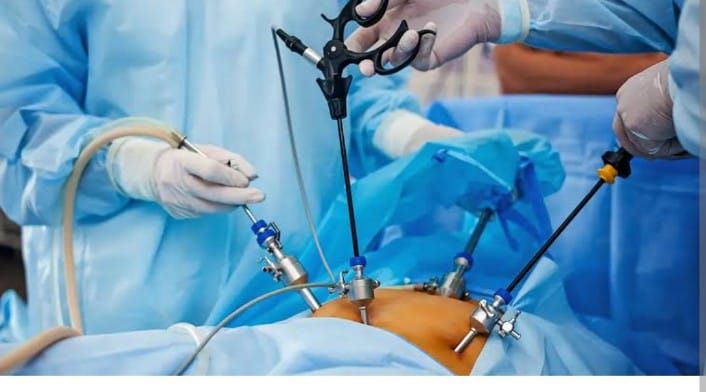 LAPAROSCOPIC SURGERY AND LAPAROSCOPIC GYNAEC PROCE... main image