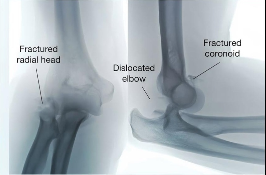 Physiotherapy clinic in Tambaram
Are you Looking f... main image
