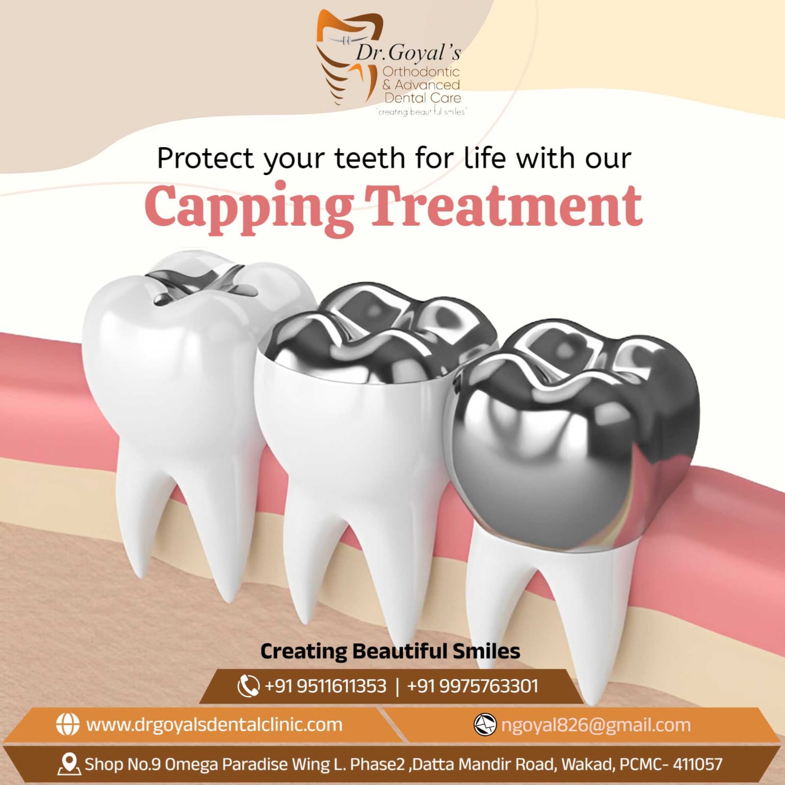 A dental crown is a tooth-shaped cap that resto... main image