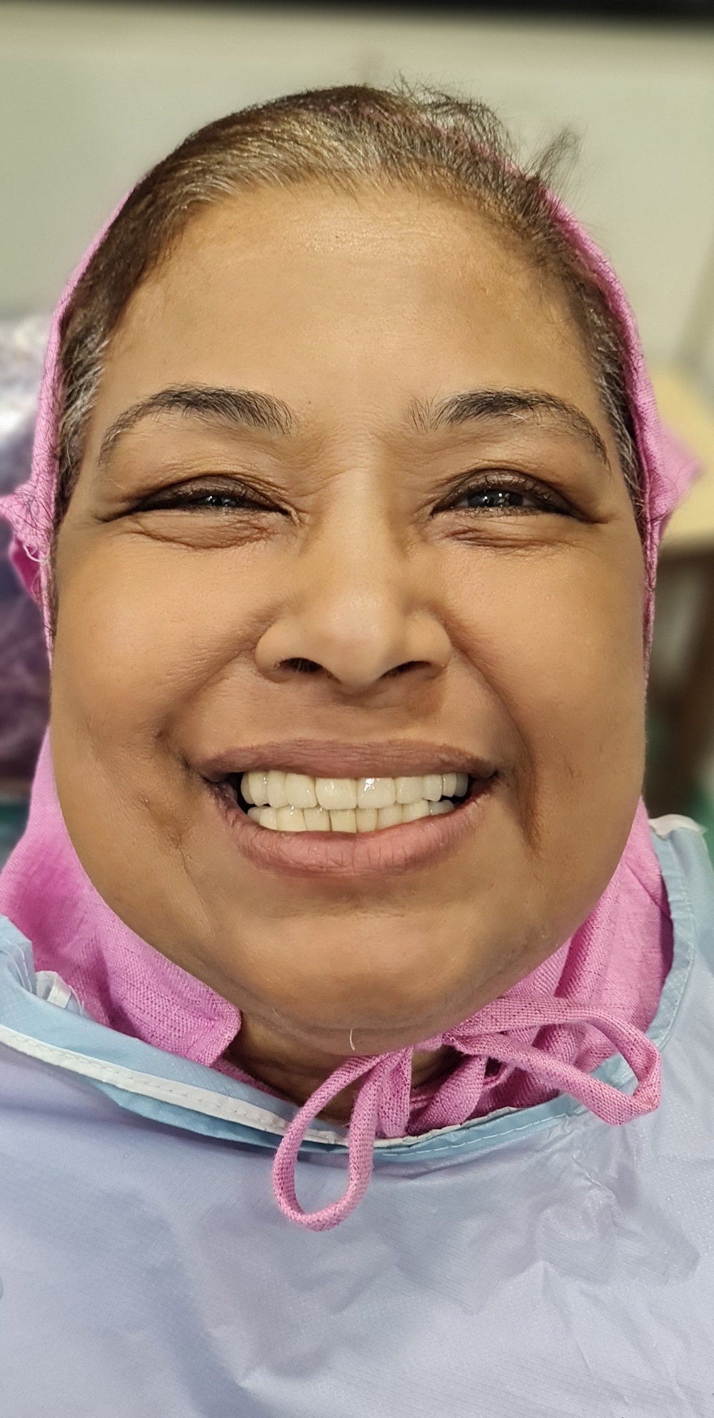 FULL MOUTH REHABILITATION is a dental treatment... main image