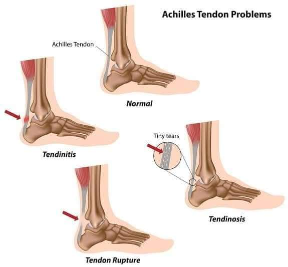 Physiotherapy clinic in Tambaram
Are you Looking f... main image