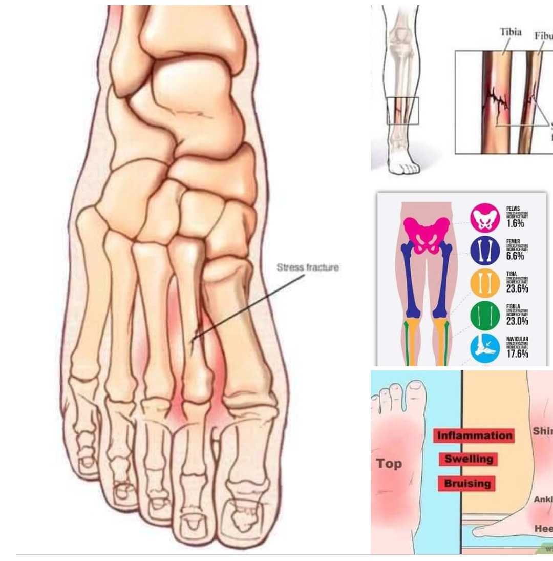 Physiotherapy clinic in Tambaram
Are you Looking f... main image