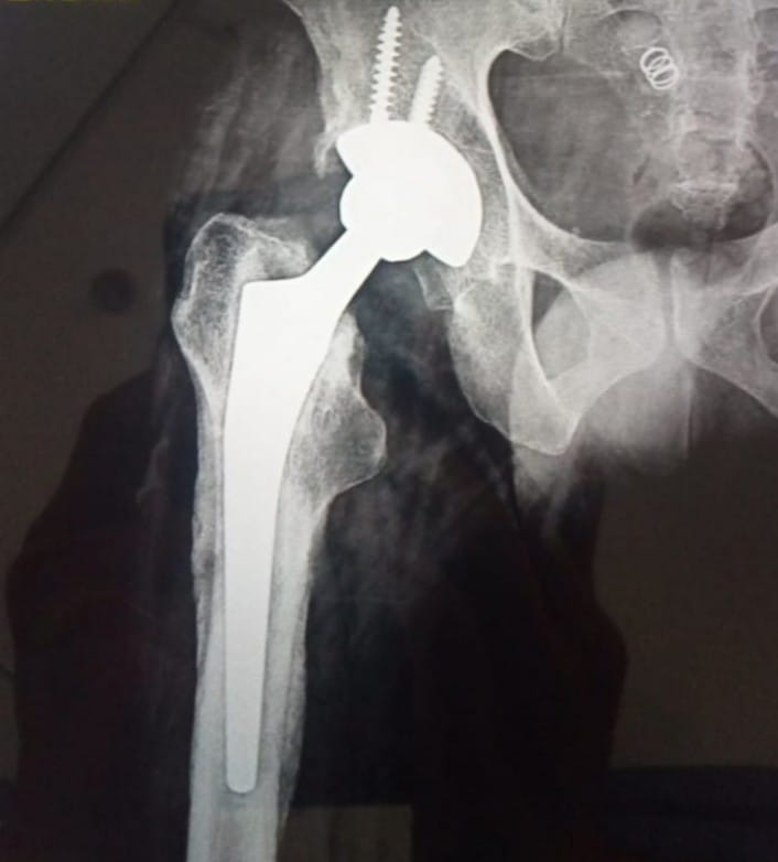 # Integrity Superspeciality hospital
# old c/o HIP... main image