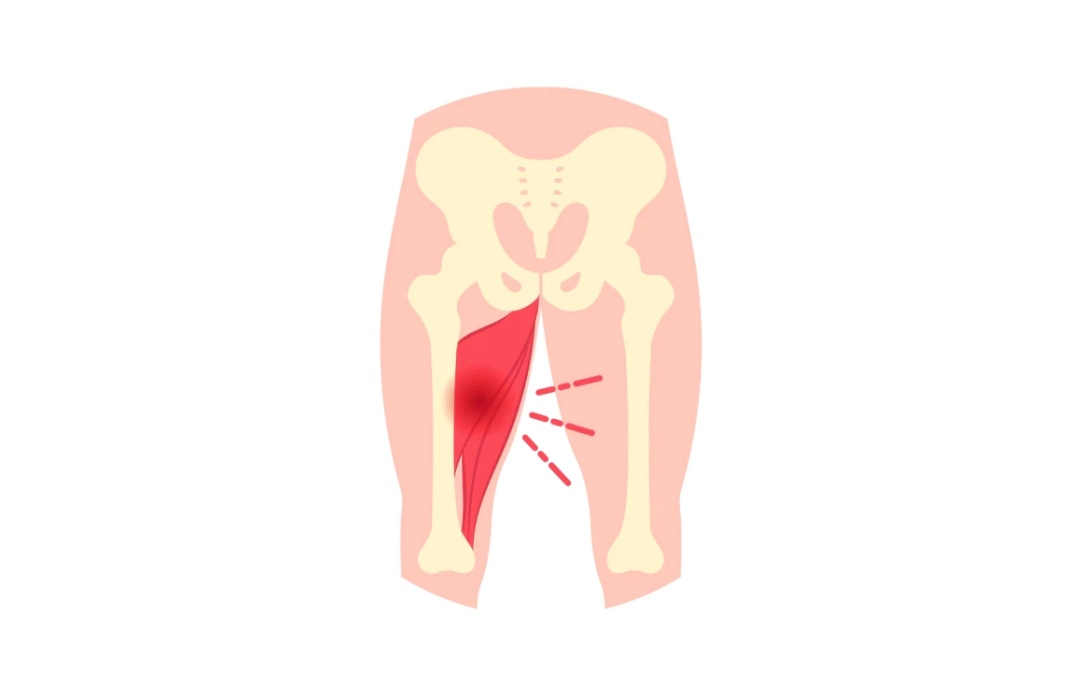 Physiotherapy clinic in Tambaram
Are you Lookin... main image