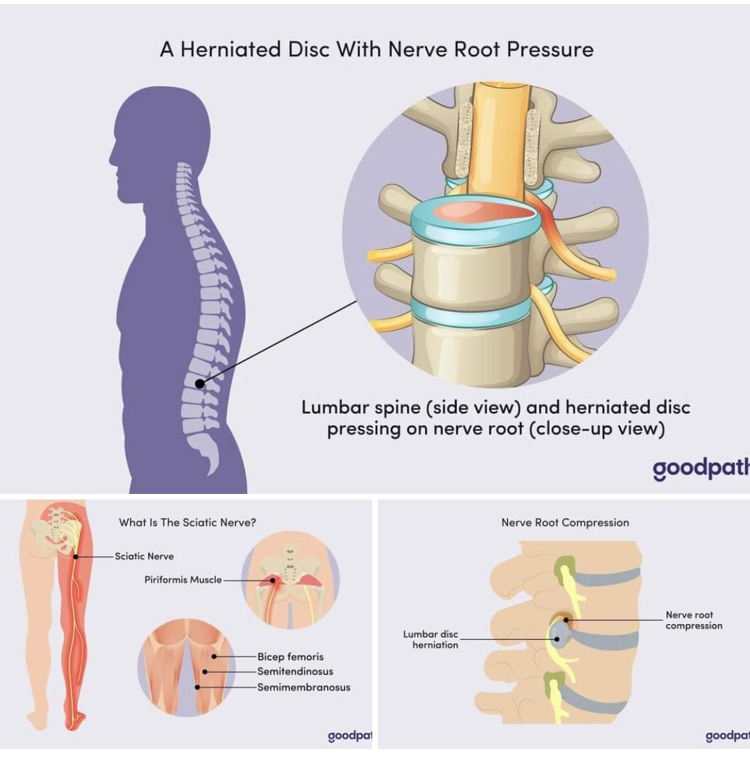Physiotherapy clinic in Tambaram
Are you Looking f... main image