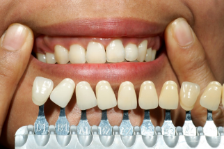 Enhance Your Smile w