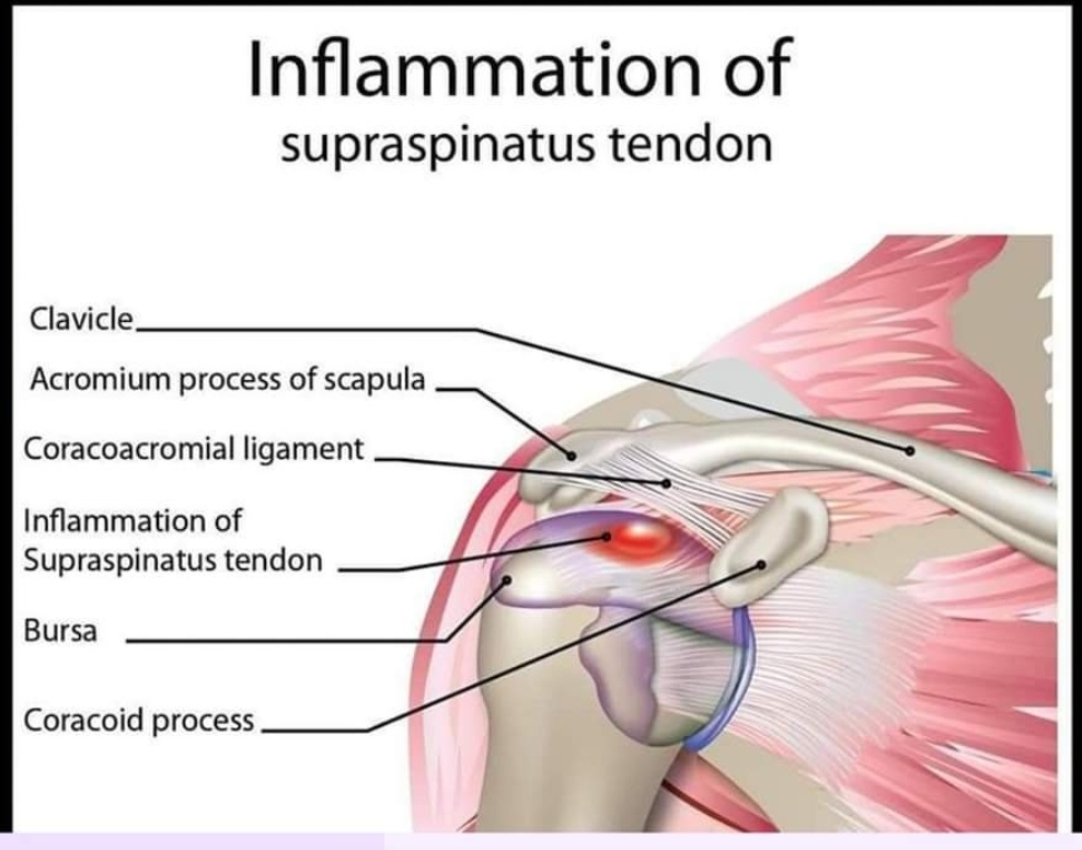 Physiotherapy clinic in Tambaram
Are you Looking f... main image