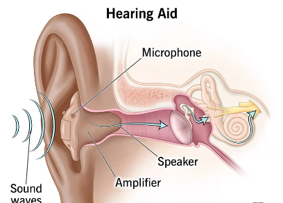 Need Hearing Aid Clinic in Rahatani, Kalewadi, ... main image