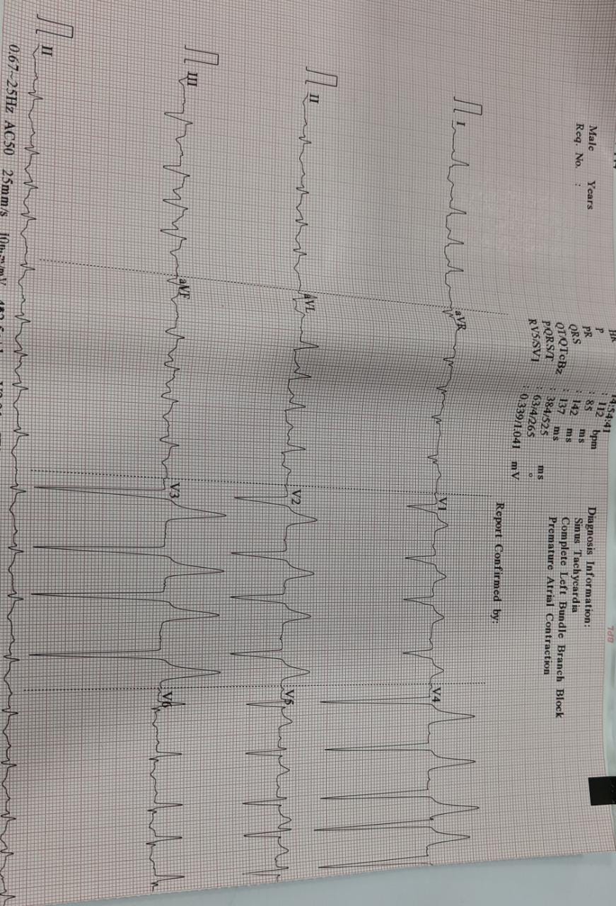 #Integritysuperspecialityhospital
#cardiacunit
#EC... main image