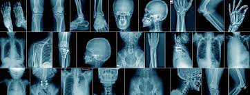 Experience the Best X-ray Services at Kothrud Hosp... main image