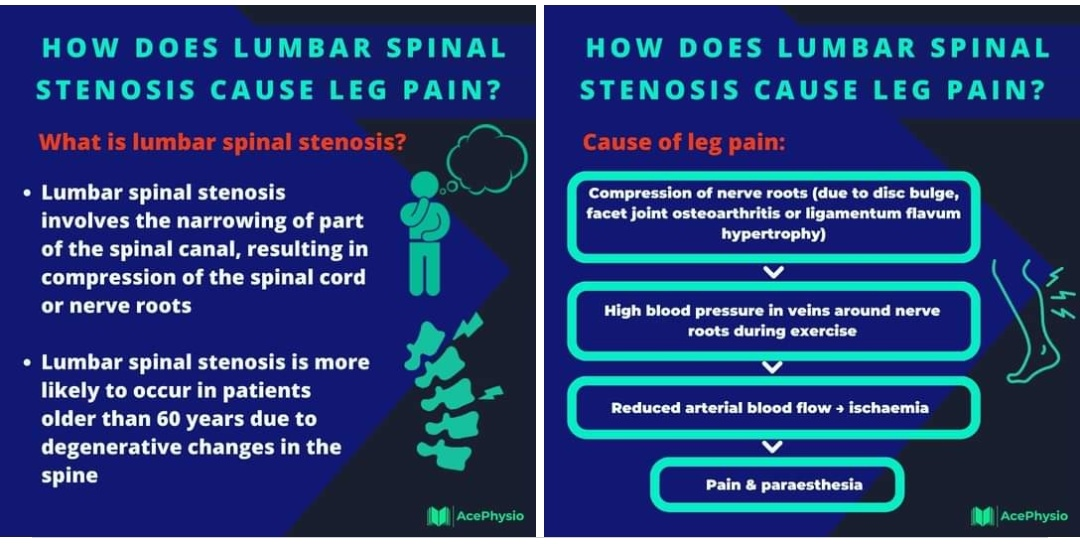 Physiotherapy clinic in Tambaram
Are you Looking f... main image