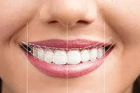 Transform Your Smile