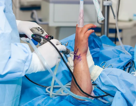 Advance Hand Surgery, Regain Functionality and ... main image