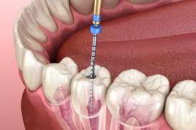 Restore Your Oral He