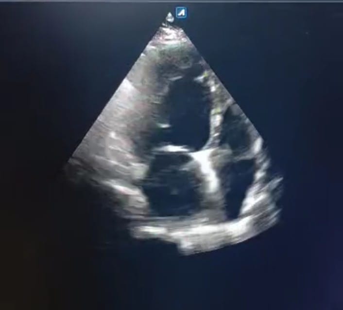 #Integritysuperspecialityhospital
#2DECHO
#Cardiac... main image
