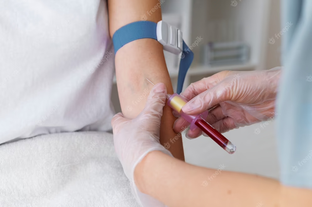 Lookinf for Allergy Test-Skin Prick Test Clinic... main image