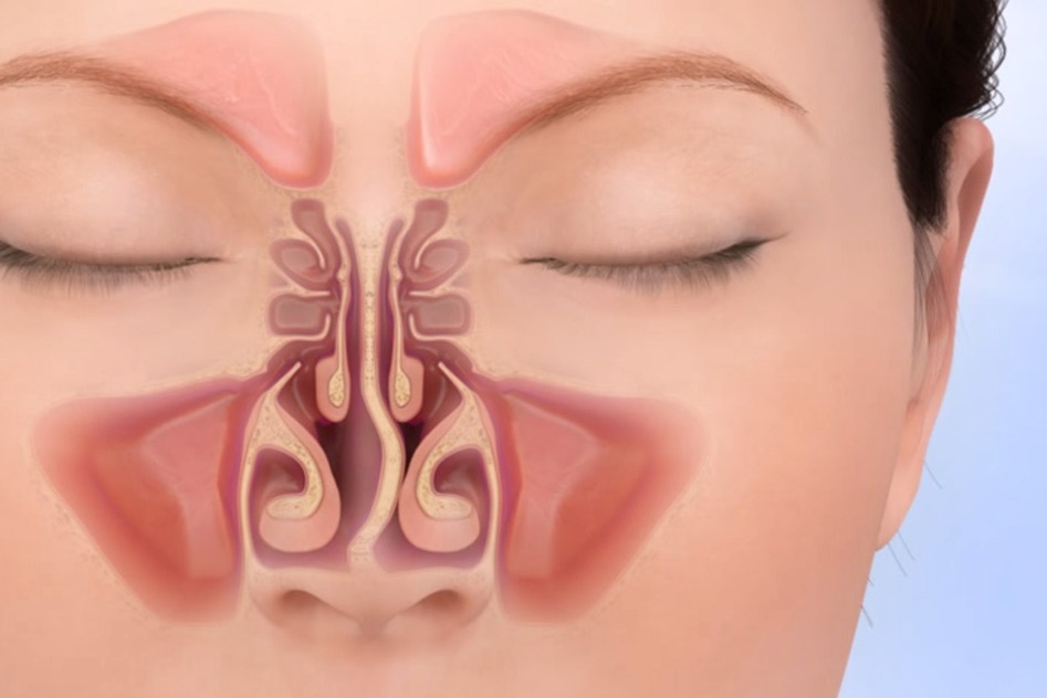 Searching Septoplasty Clinic in Rahatani, Kalew... main image
