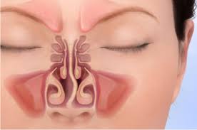 Do you need Adenoid Surgery Clinic in Rahatani, Ka... main image