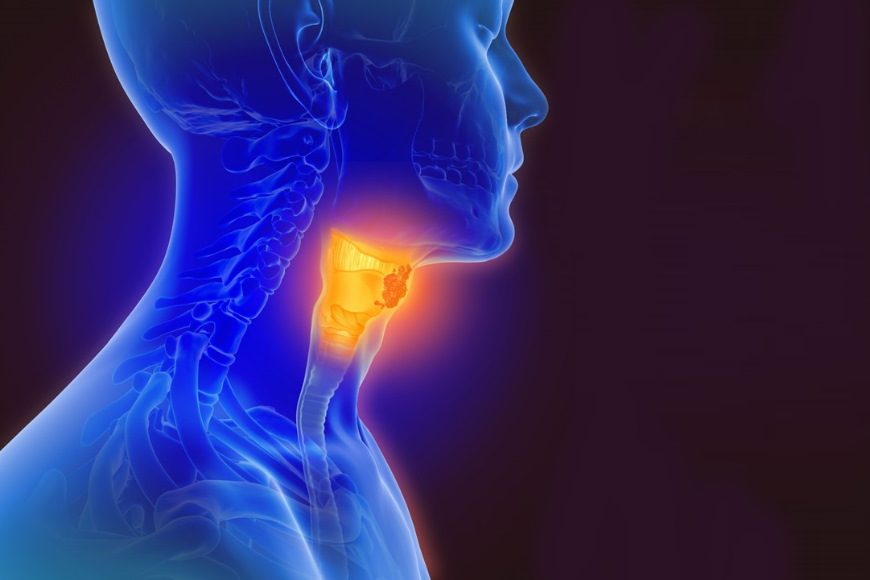 Looking for Diagnosis of Head And Neck Cancers Tre... main image