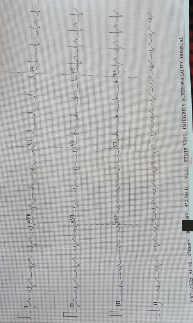#Integritysuperspecialityhospital
#ECG
#Cardiachos... main image