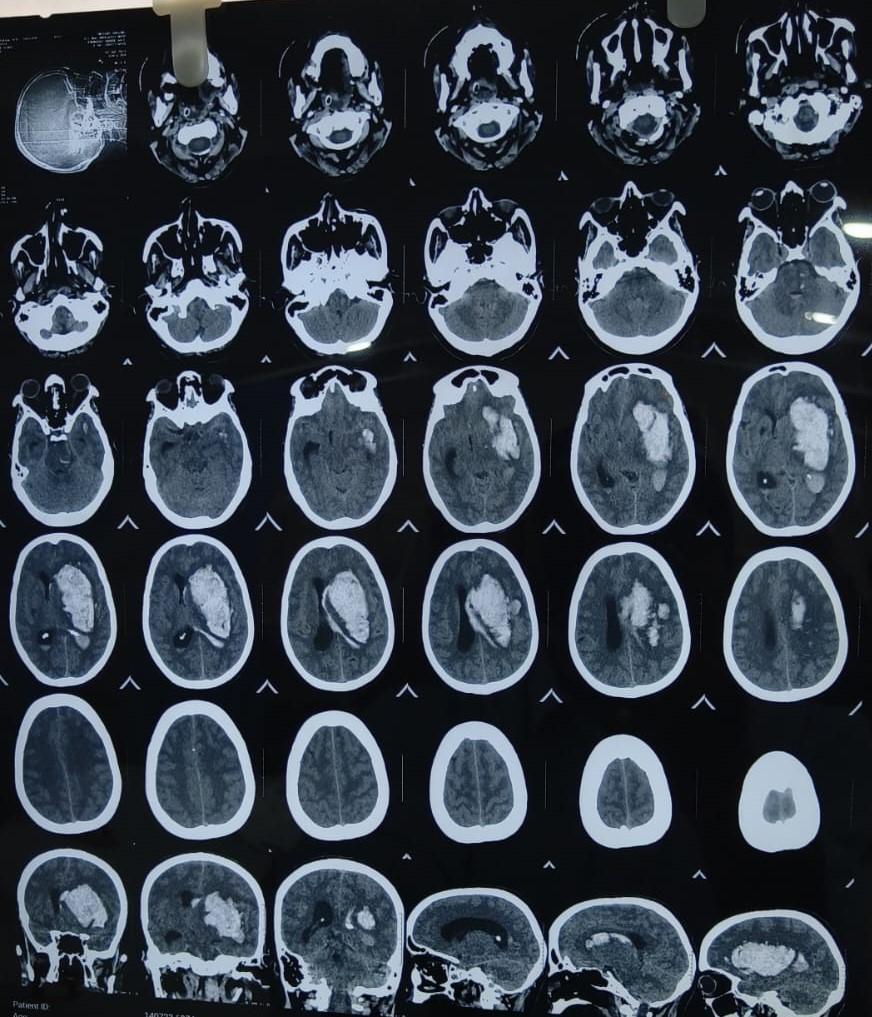 #Integritysuperspecialityhospital
#neurosurgerydep... main image