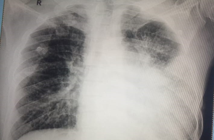 #Integritysuperspecialityhospital
#xray
#lungma... main image