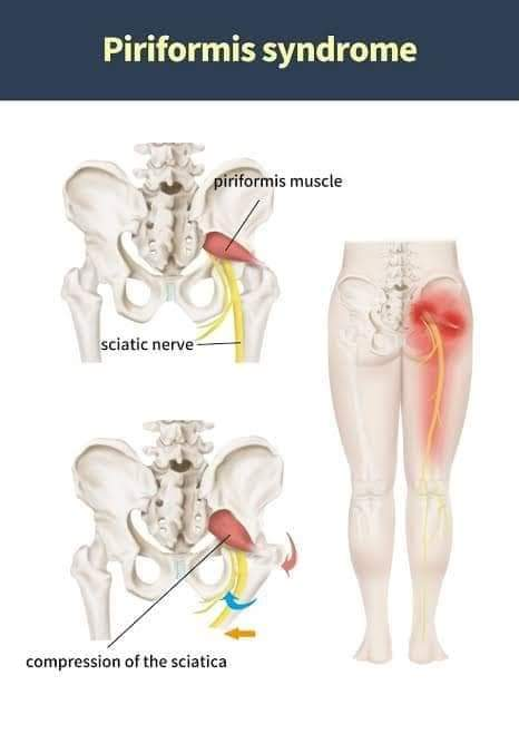 Physiotherapy clinic in Tambaram
Are you Looking f... main image