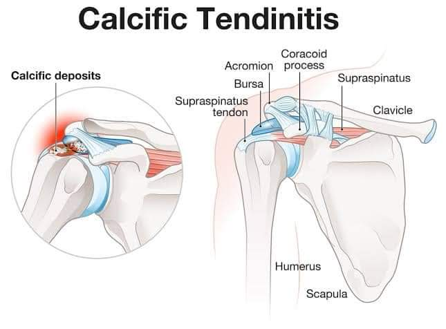 Physiotherapy clinic in Tambaram
Are you Looking f... main image