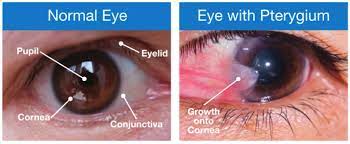 Bright Eyes Hospital - Your Relief for Symbleph... main image