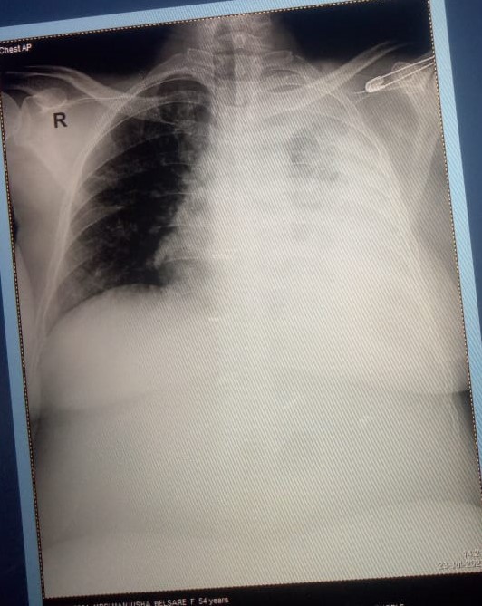 #Integritysuperspecialityhospital
#lungdiseases


... main image