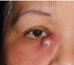 Crystal Clear Eye Institute - Your Gateway to R... main image