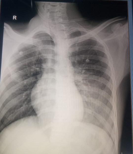 #Integritysuperspecialityhospital
#chestspecialist... main image