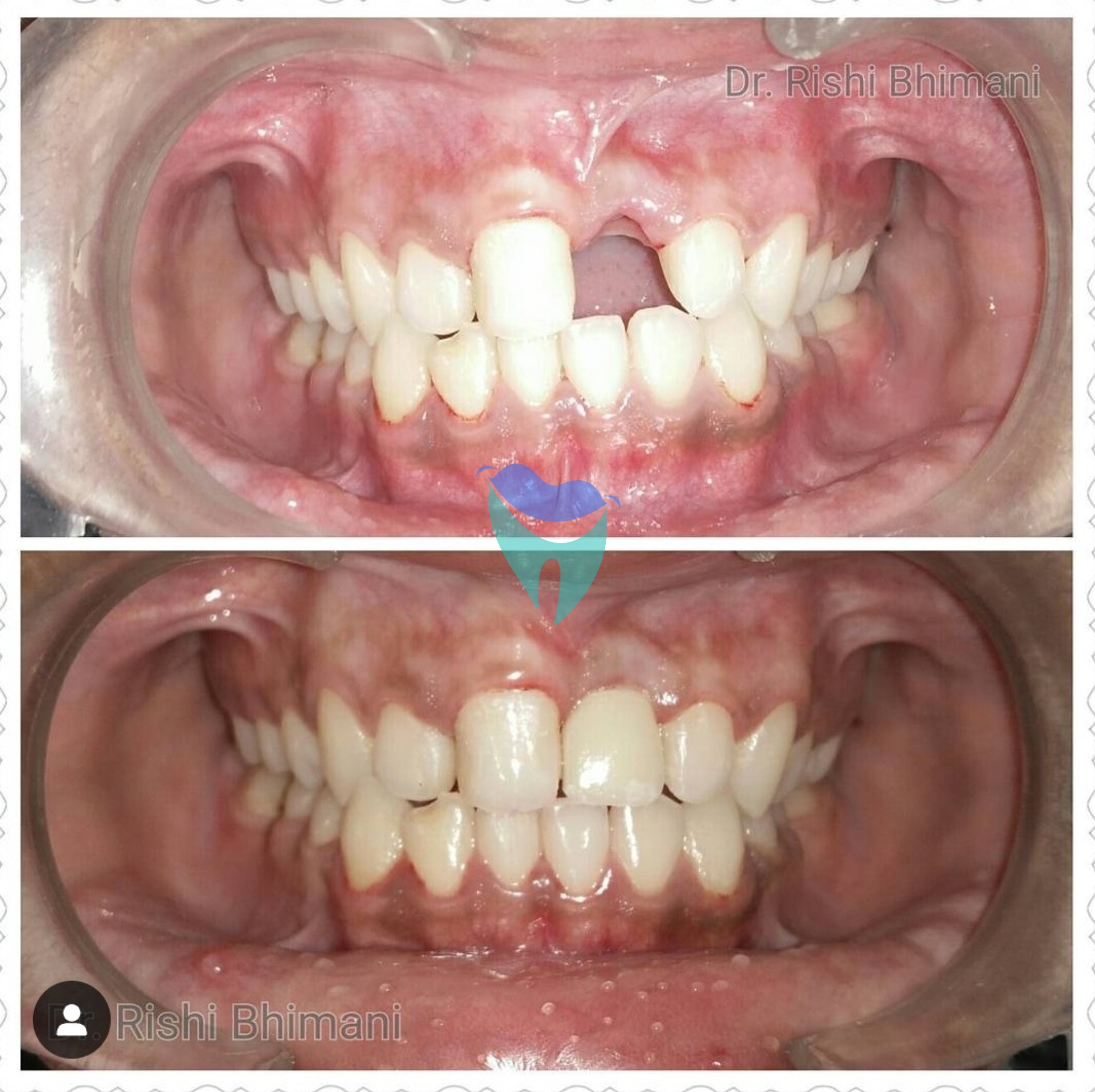 We all know that missing teeth can affect our c... main image