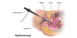 Advanced Surgery and Laparoscopy: Kothrud Hospital... main image